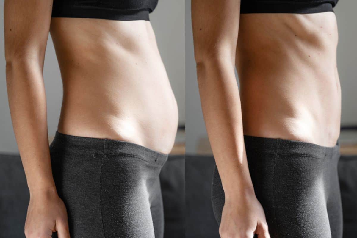 Post-Pregnancy: What Happens to Your Abdominal Muscles After Birth Cheadle