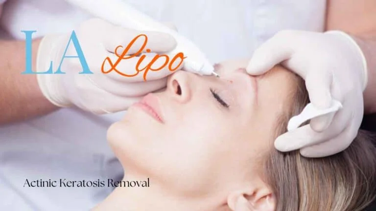 Woman receiving Actinic Keratosis Removal Treatment Cheadle