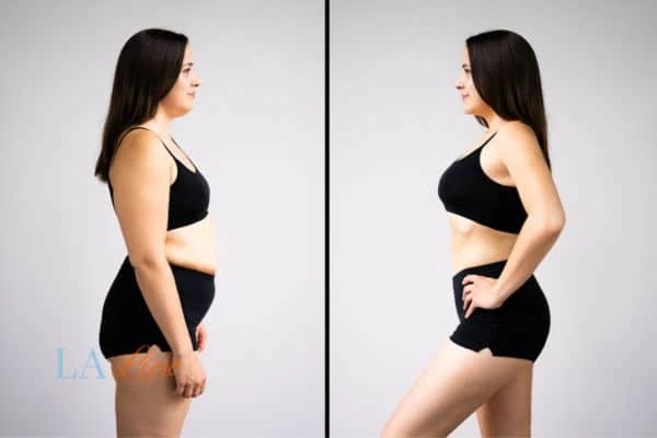 LA-EMS Body Sculpting Cheadle results before and after of womans results on body toning.