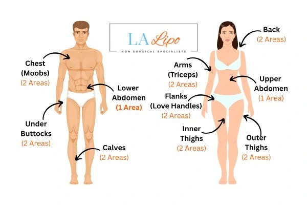 LA LIPO Cryolipolysis Areas Cheadle