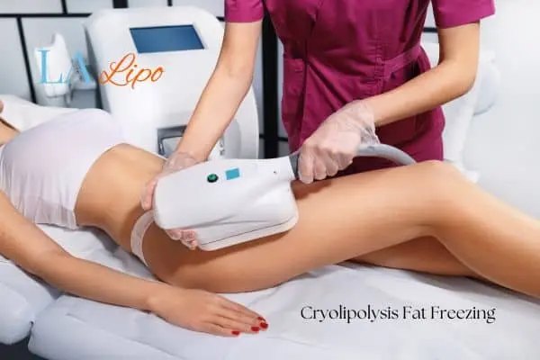 Woman receiving coolsculpting Cheadle treatment on her thighs