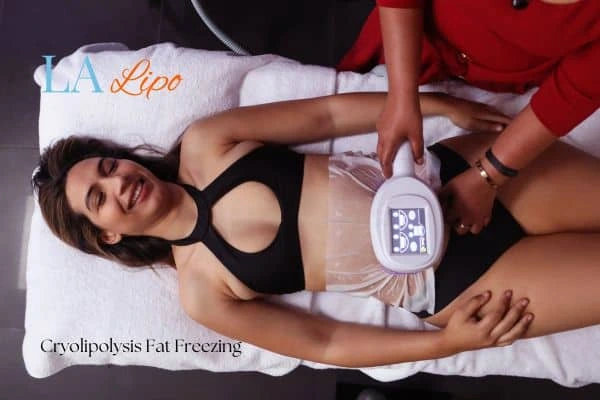 woman getting cryolipolysis Cheadle