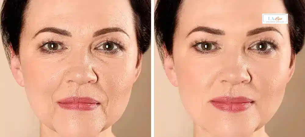 How Long Does It Take to See Results and How Long Do They Last Cheadle?