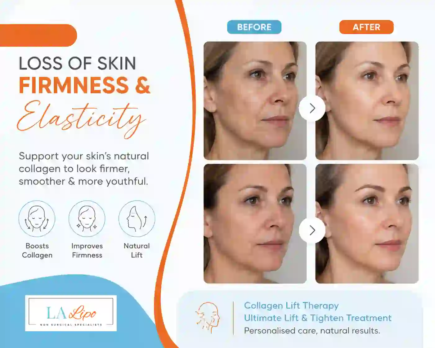 Sign #7: Loss of Skin Firmness and Elasticity Cheadle